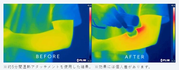 温熱アタッチメント効果